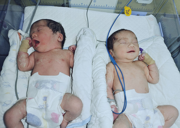 双胎宝妈成功顺产，毕节市第二人民医院以精湛技术为母婴保驾护航！